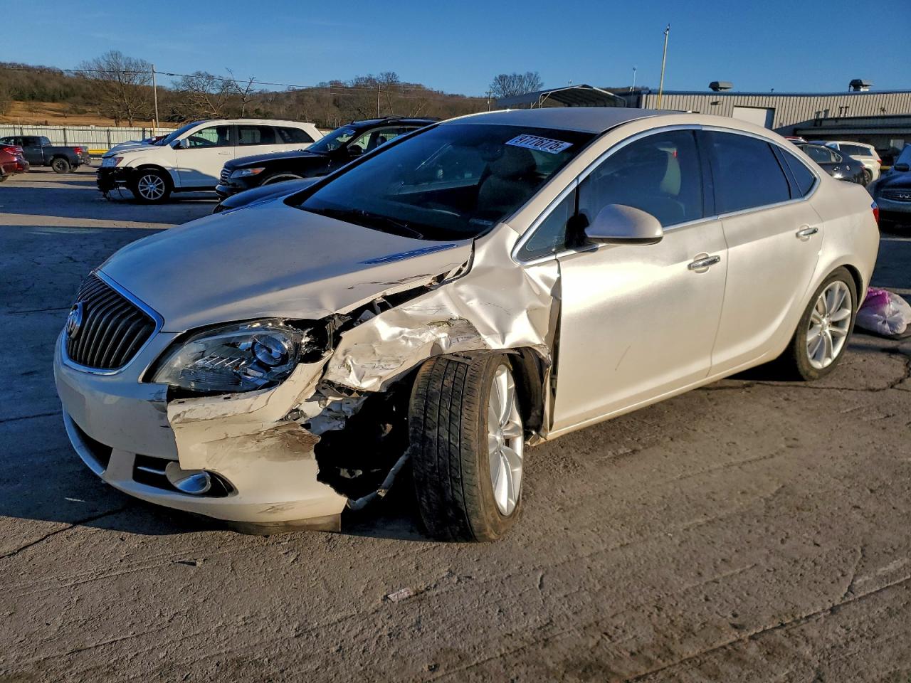 Buick Verano Convenience Image 1